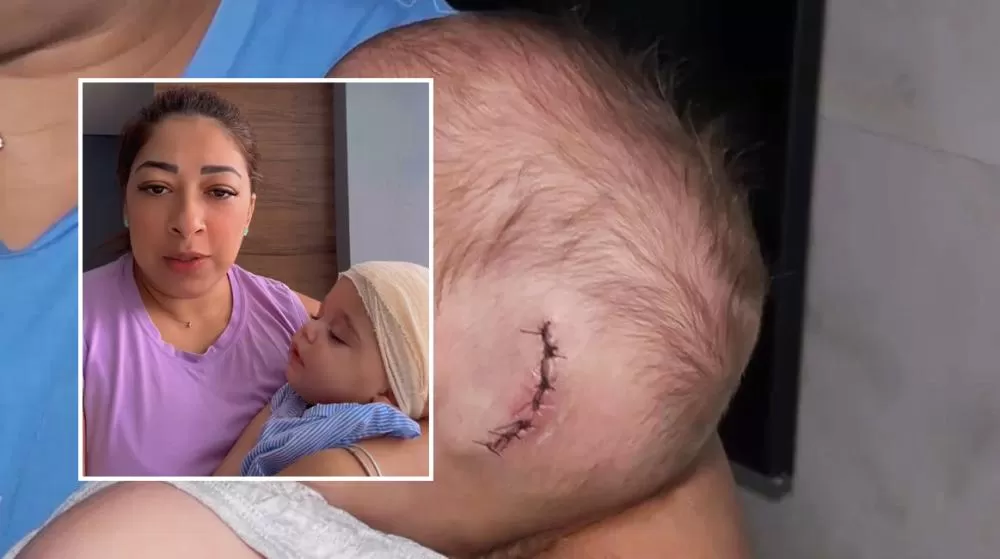 Mãe de Luca em Ji-Paraná faz Apelo para Custear Tratamento Médico Após Duas Cirurgias