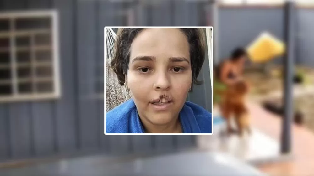 Eutanásia de Cão em Ji-Paraná Após Ataque à Tutora Levanta Debate Sobre Segurança e Responsabilidade