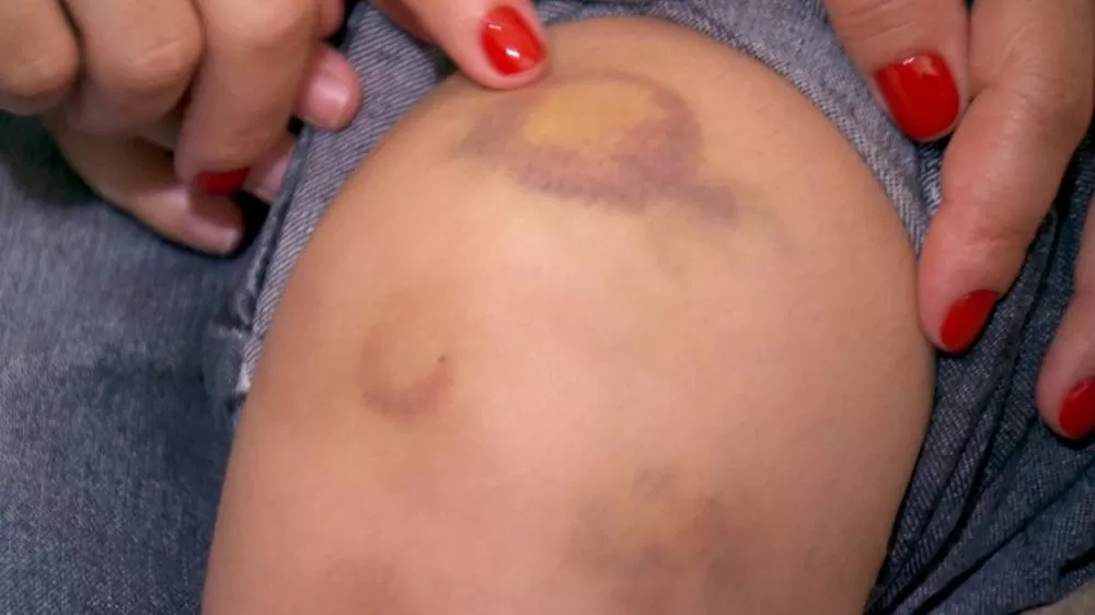 Violência Doméstica em Ji-Paraná: Mulher é Surrada com Cabo de Vassoura e Foge para Matagal – Veja Detalhes