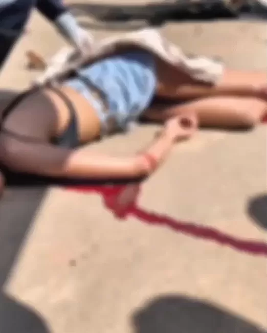 Jovem que Colidiu com Carreta no Bairro Primavera é Transferida de Ji-Paraná para Hospital em Cacoal