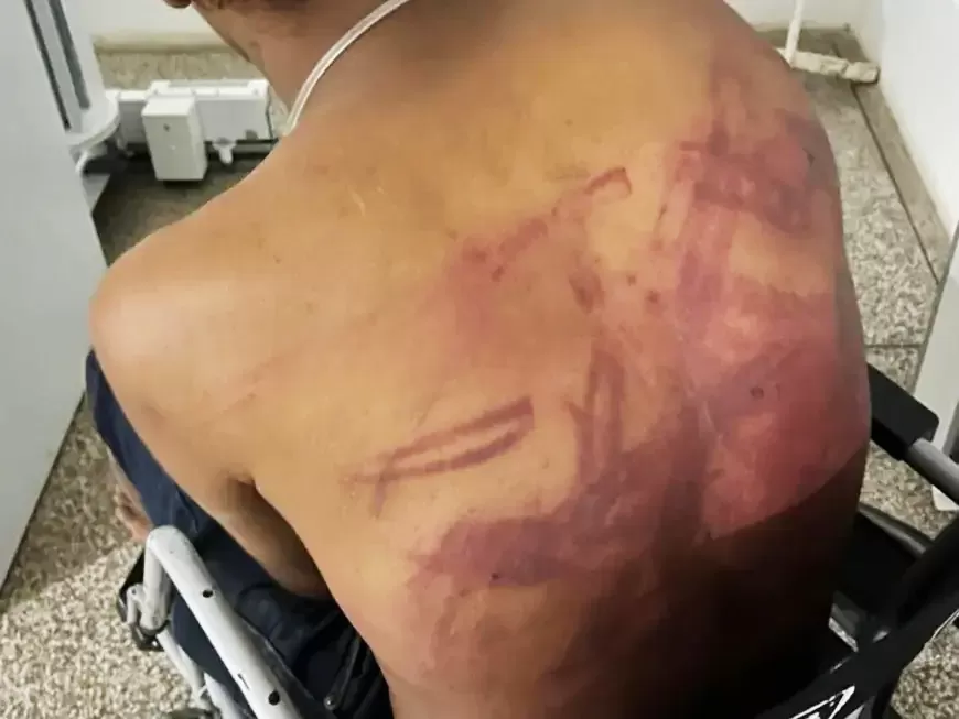 Vulgo “Cotoco” é brutalmente espancado às margens do Rio Machado e vai parar no hospital em Ji-Paraná