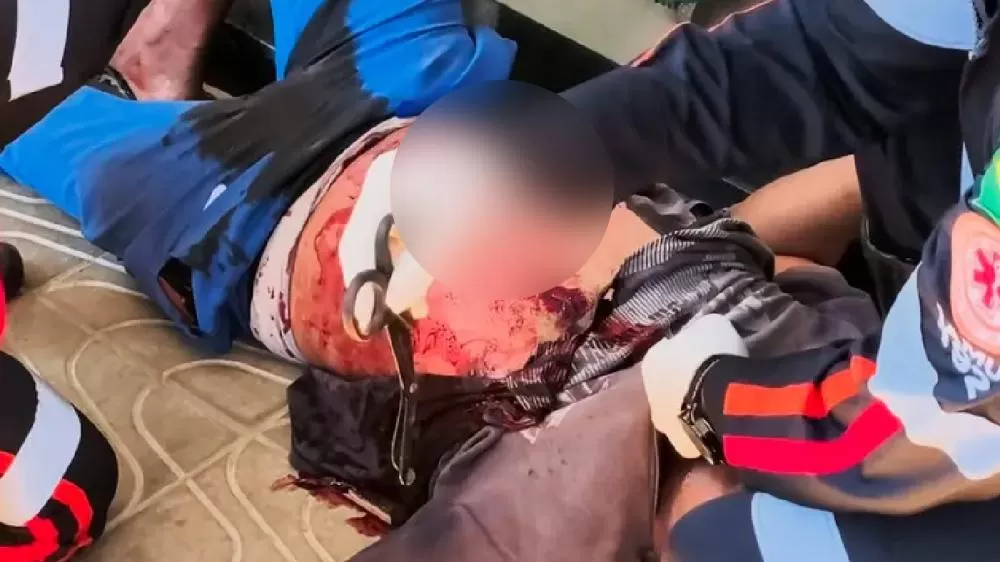 Homem é Esfaqueado no Peito em Frente a Supermercado de Ji-Paraná e Está em Estado Grave na UTI 