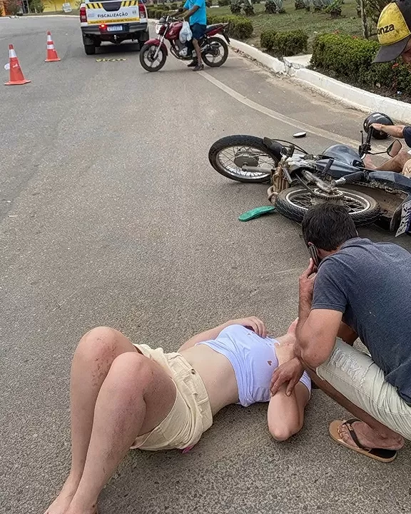 Acidente Grave em Ji-Paraná: Duas Pessoas Ficam Feridas Após Colisão Entre Motos na BR-364 