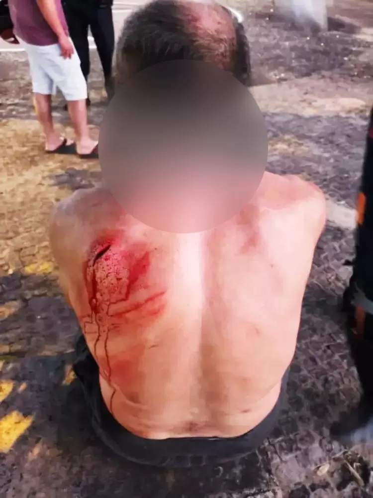 Ji-Paraná: Homem Leva Facada nas Costas e Tem Pertences Roubados nas imediações da Praça do Teatro Dominguinhos — Veja o Que Aconteceu!