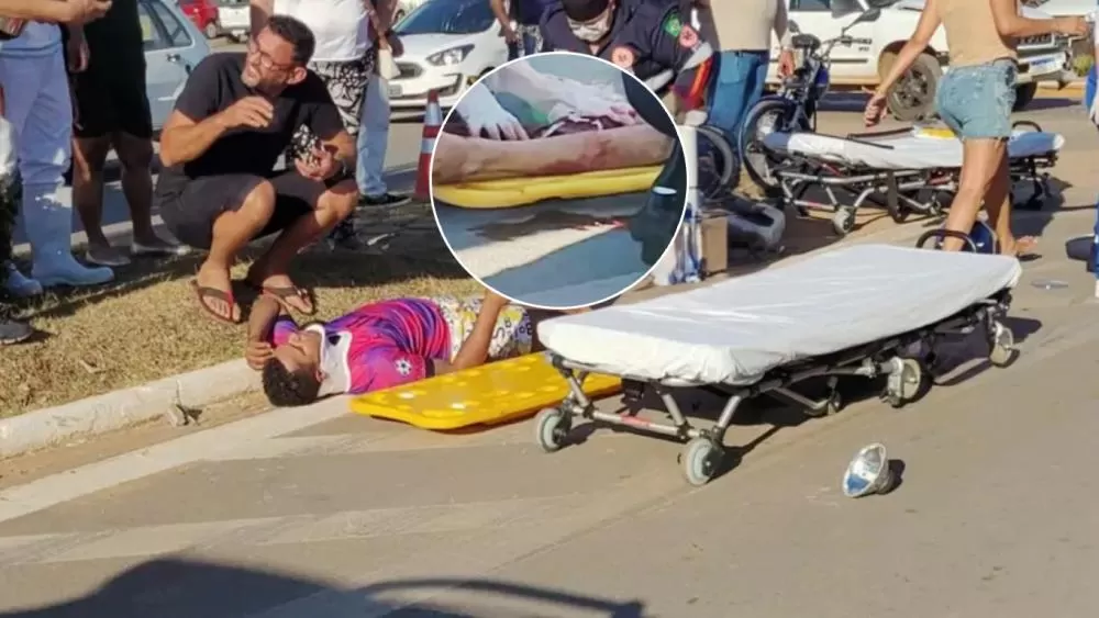 De Ji-Paraná levado para Cacoal: Motociclista sofre Fraturas Graves após Colisão Violenta com Caminhonete em Rotatória