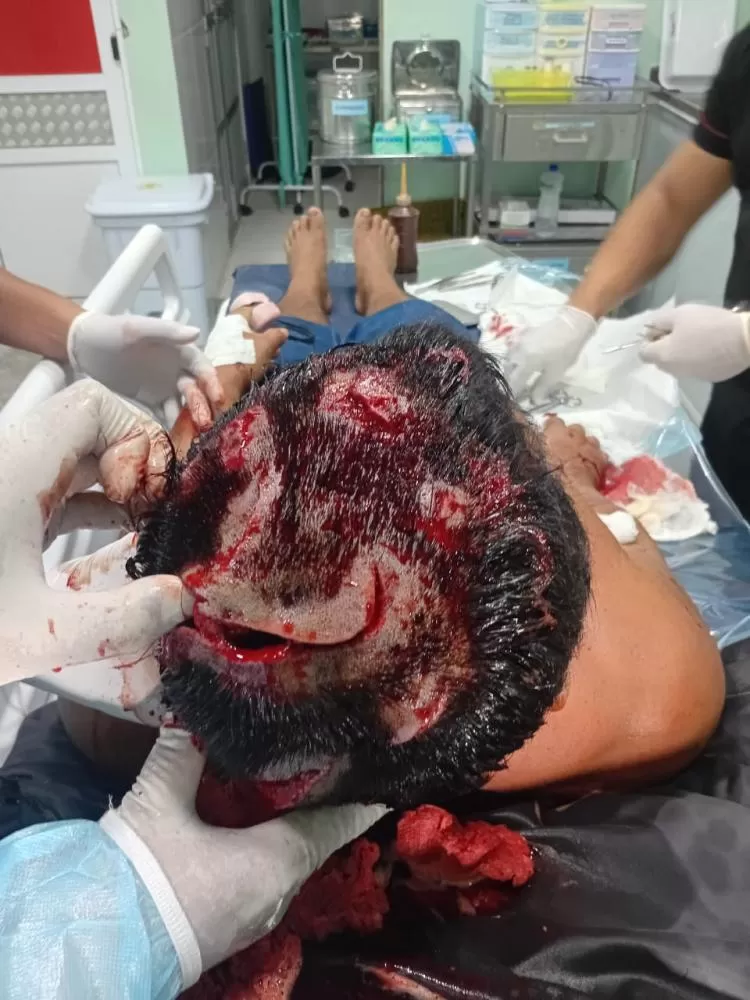 Ataque selvagem: Cacique é atacado por onça em comunidade indígena do Amazonas e sobrevive após resgate de helicóptero