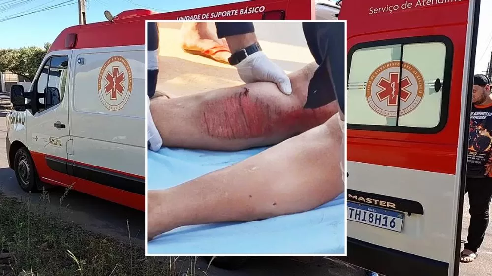 Motociclista Fica Ferida em Grave Colisão com Três Veículos em Ji-Paraná: CG Irregular e Condutor Sem CNH Aumentam Polêmica