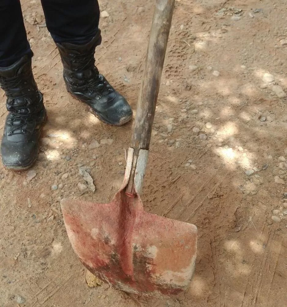 Homem Agride Ex com Golpes de Pá na Boca em Ji-Paraná: Mulher Tem Dente Quebrado em Ataque Brutal