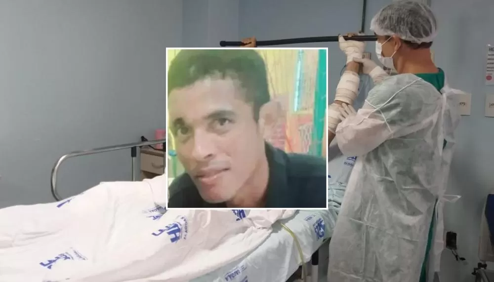 Fim trágico Ji-Paraná: Homem Queimado Pela Esposa Morre Após 10 Dias de Agonia na UTI do Hospital Candido Rondon - HCR 