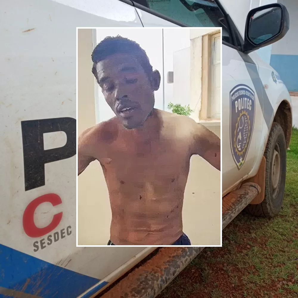 Homem Queimado Pela Esposa em Ji-Paraná Grava Vídeo Antes de Morrer e Revela sua Versão negando a Agressão