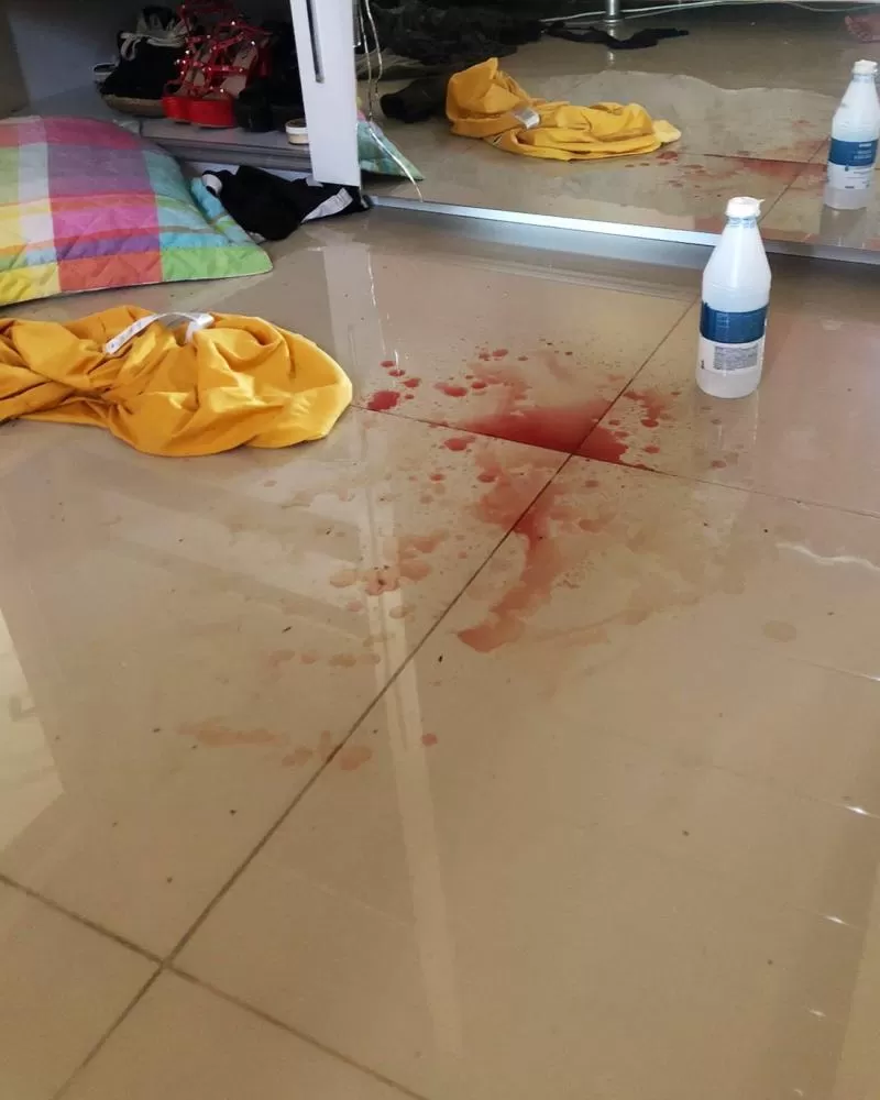 Embriagado Surta e Espanca o Padrasto com Pedaço de Pau em Ji-Paraná — Polícia é Acionada para Conter a Fúria
