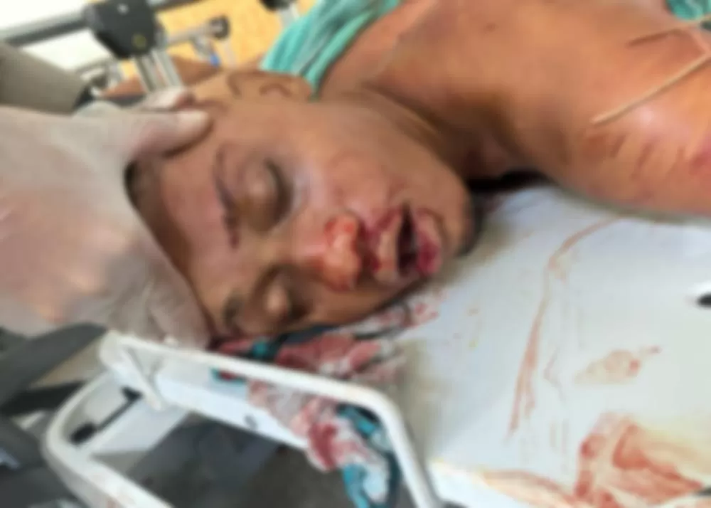 Vídeo — Cenas Fortes: Megaoperação no Rio de Janeiro deixa 121 mortos, incluindo 4 policiais, em ação histórica contra o Comando Vermelho