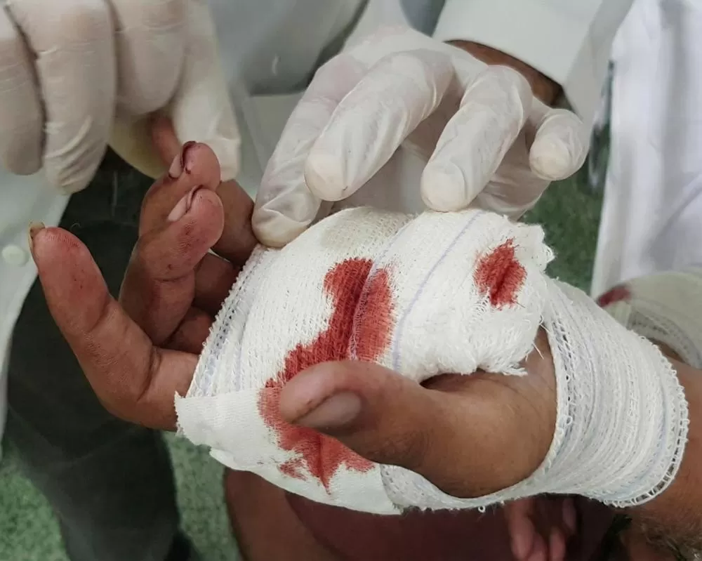 Mistério em Ji-Paraná: Homem baleado na mão vai ao Hospital Municipal e Polícia encontra arma artesanal