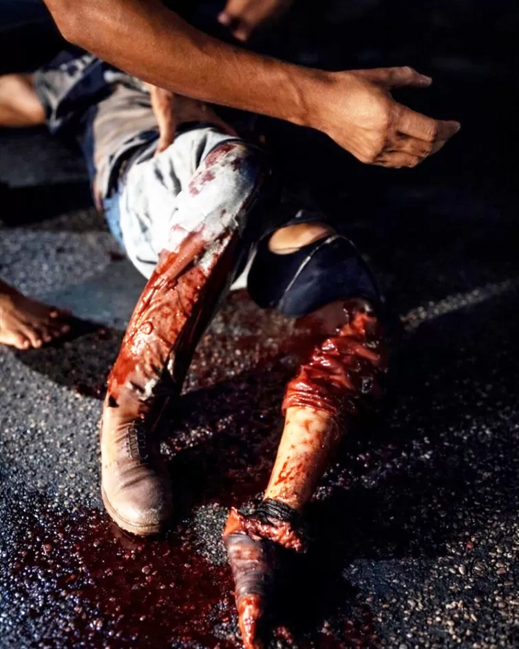 Grave colisão na RO-135 deixa motociclista em estado crítico, perna e pé dilacerado e mobiliza socorro em Ji-Paraná