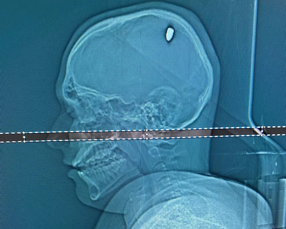 Foto: Folha de Ji-Paraná\Arquivo Pessoal