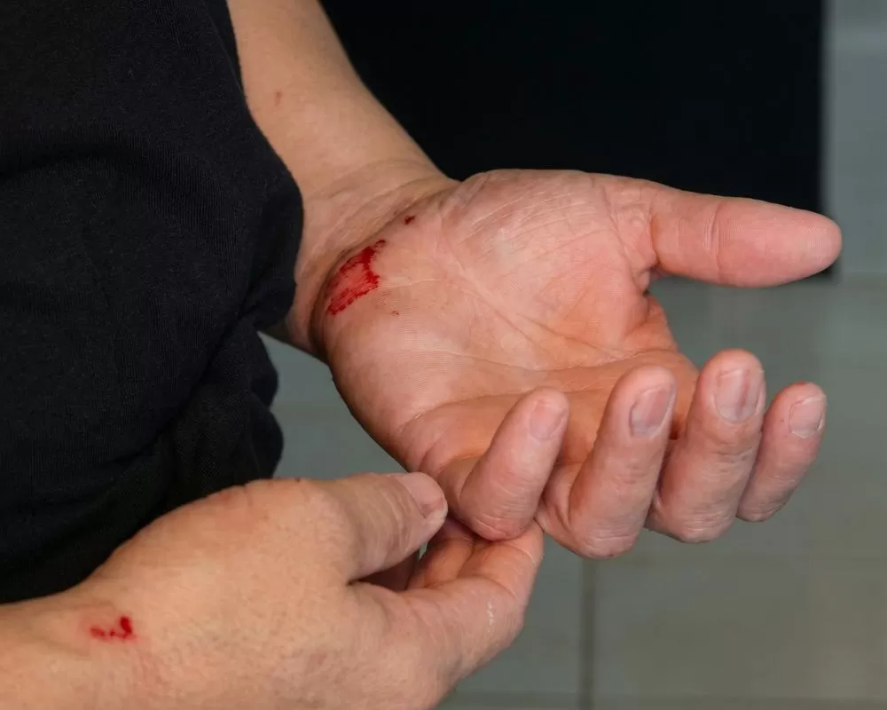 Caminhada Anti-Depressão em Ji-Paraná Vira Pesadelo: Mulher é Agredida Brutalmente na Rua