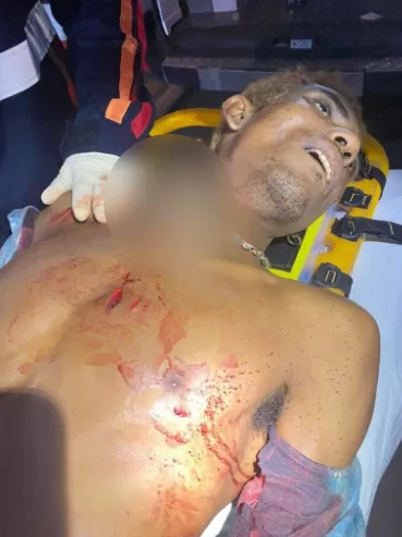 Homicídio Brutal em Ji-Paraná: Homem de 39 Anos É Morto a Facadas Durante à Madrugada