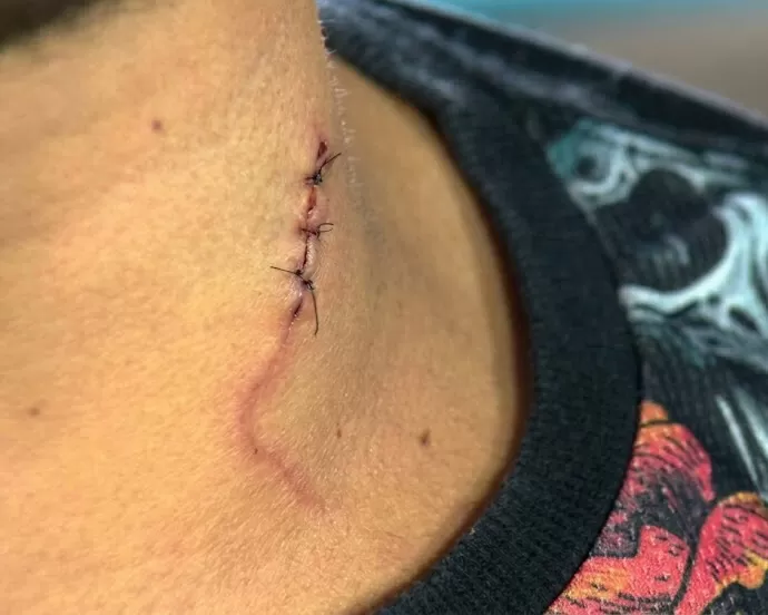 Mulher esfaqueia companheiro no pescoço em Ji-Paraná e afirma que agiu para defender a filha de agressão 