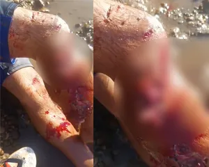 Vídeo: Pescador tem perna dilacerada após ataque Jacaré gigante medindo mais de 6 metros na Boca do Xambioazinho