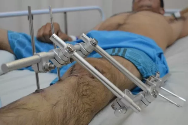 Acidentados em Rondônia Ficarão sem acesso à Novo Seguro DPVAT